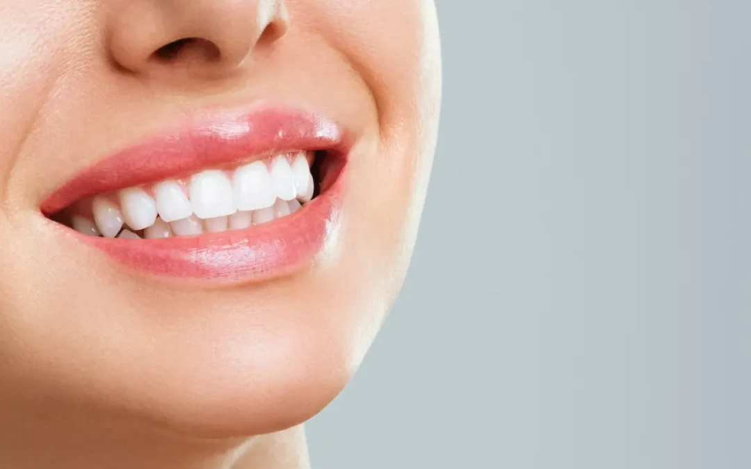 Sorriso brilhante: Veja 7 maneiras de clarear os seus dentes!